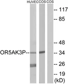 Anti-OR5AK3P antibody used in Western Blot (WB). GTX87229