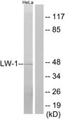 Anti-LW-1 antibody used in Western Blot (WB). GTX87231
