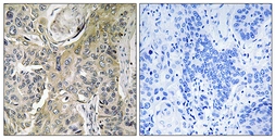 Anti-RHOBTB3 antibody used in IHC (Paraffin sections) (IHC-P). GTX87232