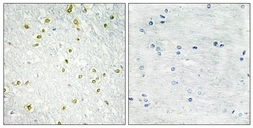 Anti-SNAPC5 antibody used in IHC (Paraffin sections) (IHC-P). GTX87239