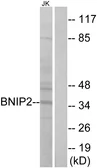 Anti-BNIP2 antibody used in Western Blot (WB). GTX87240