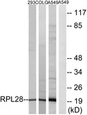 Anti-RPL28 antibody used in Western Blot (WB). GTX87242