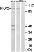 Anti-PKP2 antibody used in Western Blot (WB). GTX87244
