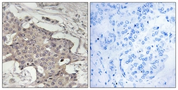 Anti-HIBADH antibody used in IHC (Paraffin sections) (IHC-P). GTX87246