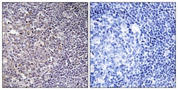 Anti-BCAS4 antibody used in IHC (Paraffin sections) (IHC-P). GTX87247