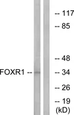 Anti-FOXR1 antibody used in Western Blot (WB). GTX87249