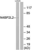 Anti-N4BP2L2 antibody used in Western Blot (WB). GTX87253
