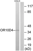 Anti-OR10D4 antibody used in Western Blot (WB). GTX87257
