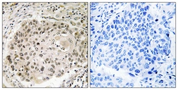 Anti-USP36 antibody used in IHC (Paraffin sections) (IHC-P). GTX87269