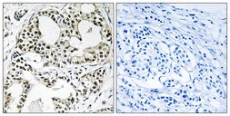 Anti-YEATS2 antibody used in IHC (Paraffin sections) (IHC-P). GTX87275