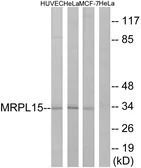 Anti-MRPL15 antibody used in Western Blot (WB). GTX87277
