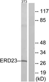Anti-KDELR3 antibody used in Western Blot (WB). GTX87279