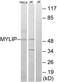 Anti-MYLIP antibody used in Western Blot (WB). GTX87284