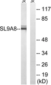 Anti-SLC9A8 antibody used in Western Blot (WB). GTX87292