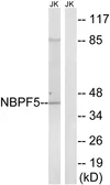 Anti-NBPF5 antibody used in Western Blot (WB). GTX87293
