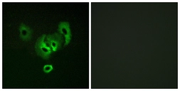 Anti-STEAP2 antibody used in Immunocytochemistry/ Immunofluorescence (ICC/IF). GTX87297