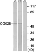Anti-CCZ1B antibody used in Western Blot (WB). GTX87298