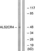 Anti-ALS2CR4 antibody used in Western Blot (WB). GTX87300
