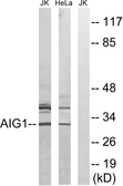Anti-AIG1 antibody used in Western Blot (WB). GTX87301