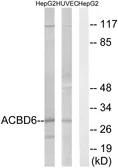 Anti-ACBD6 antibody used in Western Blot (WB). GTX87303