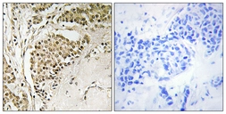 Anti-NOM1 antibody used in IHC (Paraffin sections) (IHC-P). GTX87304