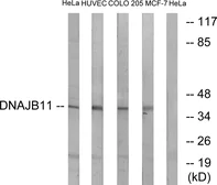 Anti-DNAJB11 antibody used in Western Blot (WB). GTX87306