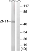 Anti-SLC30A1 antibody used in Western Blot (WB). GTX87313