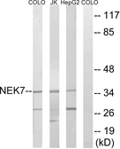 Anti-NEK7 antibody used in Western Blot (WB). GTX87316