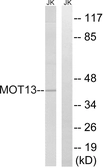 Anti-MCT13 antibody used in Western Blot (WB). GTX87317