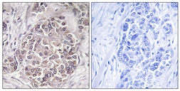 Anti-PEX1 antibody used in IHC (Paraffin sections) (IHC-P). GTX87318