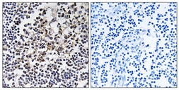 Anti-PGLS antibody used in IHC (Paraffin sections) (IHC-P). GTX87319