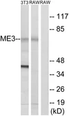 Anti-ME3 antibody used in Western Blot (WB). GTX87324