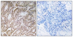 Anti-Ubiquilin 4 antibody used in IHC (Paraffin sections) (IHC-P). GTX87325