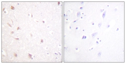 Anti-NIFK antibody used in IHC (Paraffin sections) (IHC-P). GTX87326