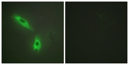 Anti-Lymphotoxin beta antibody used in Immunocytochemistry/ Immunofluorescence (ICC/IF). GTX87332