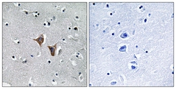 Anti-WASF4 antibody used in IHC (Paraffin sections) (IHC-P). GTX87335