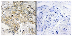 Anti-TM4SF1 antibody used in IHC (Paraffin sections) (IHC-P). GTX87337