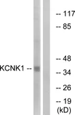 Anti-KCNK1 antibody used in Western Blot (WB). GTX87344