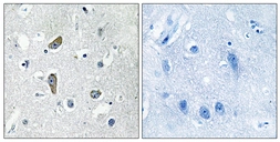 Anti-CDK5RAP2 antibody used in IHC (Paraffin sections) (IHC-P). GTX87345