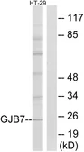 Anti-GJB7 antibody used in Western Blot (WB). GTX87346