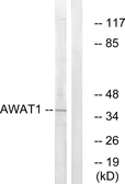 Anti-AWAT1 antibody used in Western Blot (WB). GTX87349