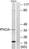 Anti-ACER3 antibody used in Western Blot (WB). GTX87351