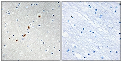 Anti-ZNF596 antibody used in IHC (Paraffin sections) (IHC-P). GTX87352