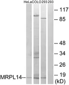 Anti-MRPL14 antibody used in Western Blot (WB). GTX87353