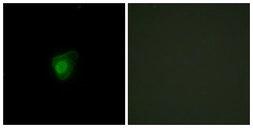 Anti-SMG7 antibody used in Immunocytochemistry/ Immunofluorescence (ICC/IF). GTX87360