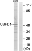 Anti-UBFD1 antibody used in Western Blot (WB). GTX87365