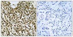 Anti-POLR3E antibody used in IHC (Paraffin sections) (IHC-P). GTX87366