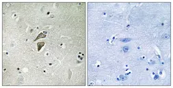 Anti-RNF149 antibody used in IHC (Paraffin sections) (IHC-P). GTX87367