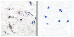 Anti-JM4 antibody used in IHC (Paraffin sections) (IHC-P). GTX87370