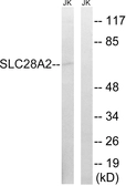 Anti-SLC28A2 antibody used in Western Blot (WB). GTX87380